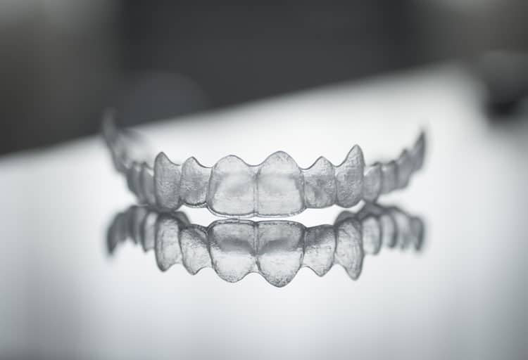 Clear aligners | Aurora Family Dentistry